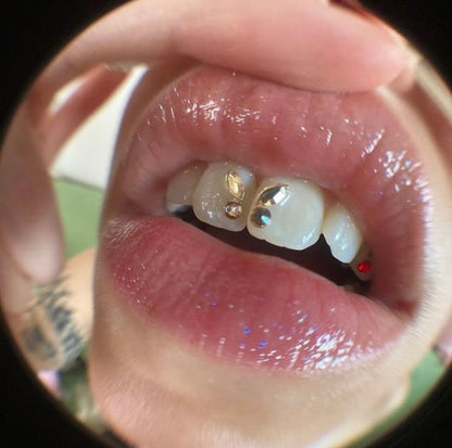 Tooth Gem Starter Kit - MoonRock Gems