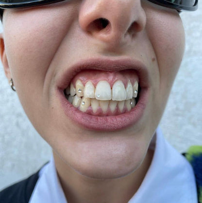 Tooth Gem Starter Kit - MoonRock Gems